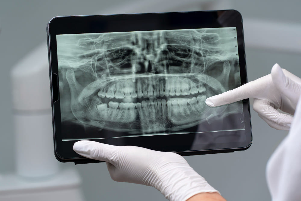 cad cam dentale