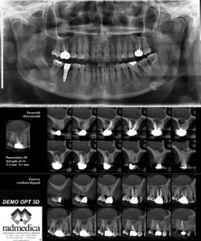 tac 3D cone beam