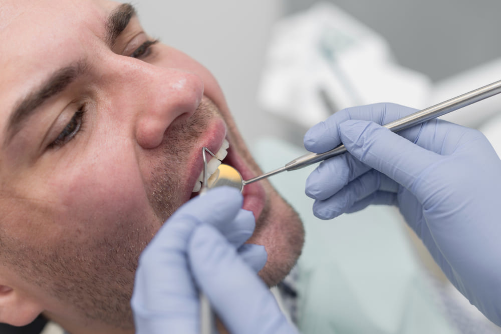 perimplantite cause cura e rimedi