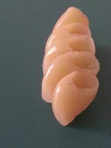 protesi dentaria provvisoria