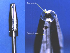 impianto osteointegrato